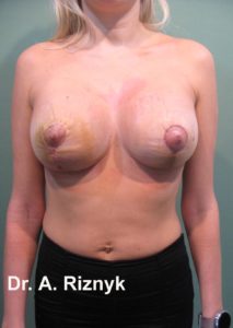 mamo14