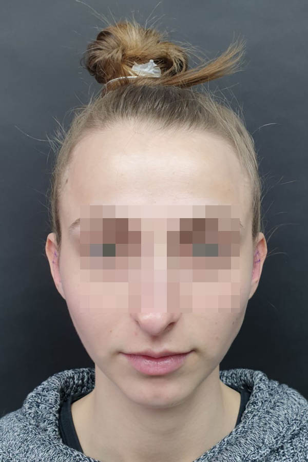 пластика вух ціна львів