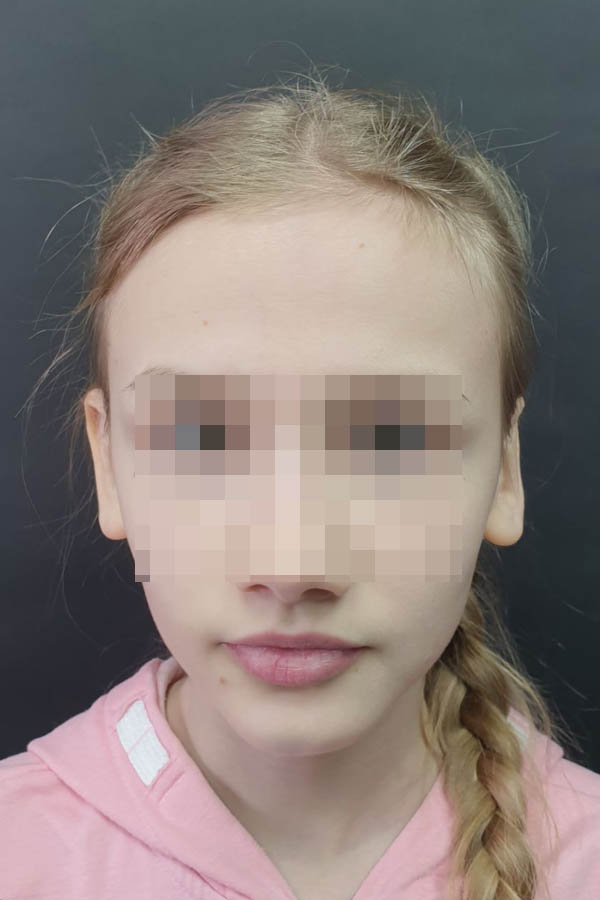 отопластика ціна львів